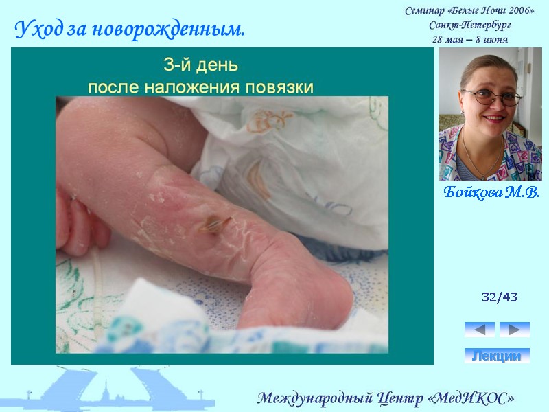 32/43 Лекции Уход за новорожденным. Бойкова М.В.